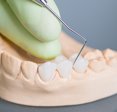 Close-up of artificial teeth with a dental tool demonstrating a procedure.